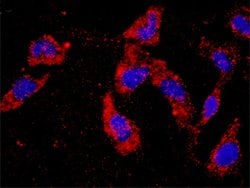 PDGFRB(phospho Y740) PDGFRB Protein Phosphorylation Antibody Pair, Abnova