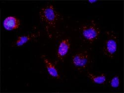 DNMT1(phospho Y969) DNMT1 Protein Phosphorylation Antibody Pair, Abnova 1 Set | Buy Online | Abnova | Fisher Scientific