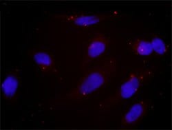 DNMT1(phospho S714) DNMT1 Protein Phosphorylation Antibody Pair, Abnova