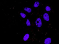 NFKB1(phospho S337) NFKB1 Protein Phosphorylation Antibody Pair, Abnova 1 Set | Buy Online | Abnova | Fisher Scientific