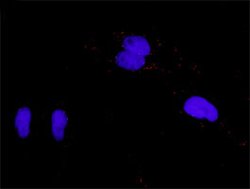 FGFR1(phospho Y154) FGFR1 Protein Phosphorylation Antibody Pair, Abnova