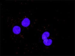 E2F1(phospho S364) E2F1 Protein Phosphorylation Antibody Pair, Abnova 1 Set | Buy Online | Abnova | Fisher Scientific