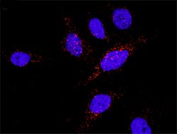 MET(phospho Y1349) MET Protein Phosphorylation Antibody Pair, Abnova 1