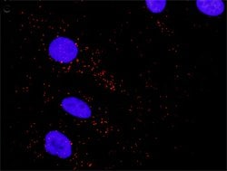 BAD(phospho S75) BAD Protein Phosphorylation Antibody Pair, Abnova 1 Set;