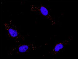 TP53(phospho S46) TP53 Protein Phosphorylation Antibody Pair, Abnova 1 Set | Buy Online | Abnova | Fisher Scientific