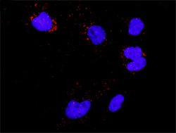 MDM2(phospho S166) MDM2 Protein Phosphorylation Antibody Pair, Abnova 1