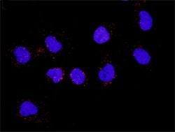 TP53(phospho S46) TP53 Protein Phosphorylation Antibody Pair, Abnova 1 Set | Buy Online | Abnova | Fisher Scientific