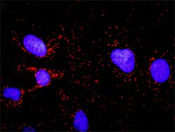 GSK3B(phospho S9) GSK3B Protein Phosphorylation Antibody Pair, Abnova 1 Set | Buy Online | Abnova | Fisher Scientific