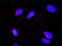 ELK1(phospho T417) ELK1 Protein Phosphorylation Antibody Pair, Abnova 1 Set | Buy Online | Abnova | Fisher Scientific