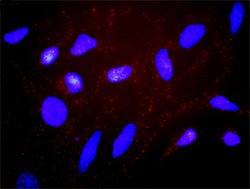 ESR1(phospho S118) ESR1 Protein Phosphorylation Antibody Pair, Abnova 1