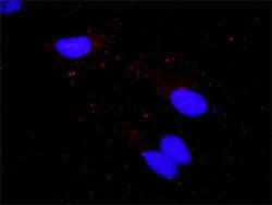 PLCG1(phospho Y783) PLCG1 Protein Phosphorylation Antibody Pair, Abnova