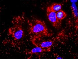PRKDC(phospho T2609) PRKDC Protein Phosphorylation Antibody Pair, Abnova