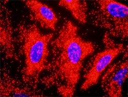 CDKN1A(phospho T145) CDKN1A Protein Phosphorylation Antibody Pair, Abnova 1 Set | Buy Online | Abnova | Fisher Scientific