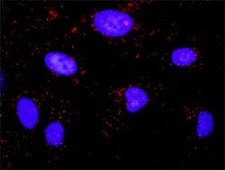 PTK2(phospho Y397) PTK2 Protein Phosphorylation Antibody Pair, Abnova 1 Set | Buy Online | Abnova | Fisher Scientific