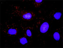 SMAD2(phospho S467) SMAD2 Protein Phosphorylation Antibody Pair, Abnova