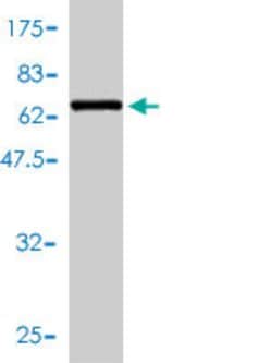 ADA, Mouse anti-Human, Polyclonal Antibody, Abnova 50&mu;L; Unconjugated:Antibodies,