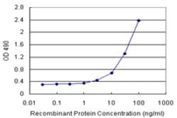 ADH1C (Human) Matched Antibody Pair, Abnova 1 Set; Unconjugated:Antibodies