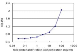 ALOX12 (Human) Matched Antibody Pair, Abnova 1 Set; Unconjugated:Antibodies