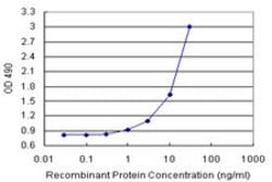 ANXA5 (Human) Matched Antibody Pair, Abnova 1 Set; Unconjugated:Antibodies
