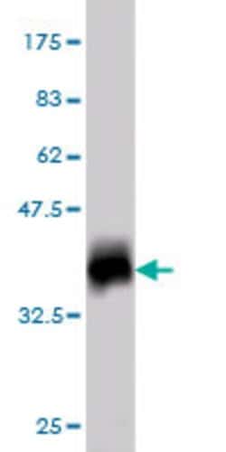 ATP5G1, Mouse anti-Human, Clone: 1A12, Abnova 100&mu;g; Unconjugated:Antibodies,