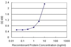 CALML3 (Human) Matched Antibody Pair, Abnova 1 Set; Unconjugated:Antibodies