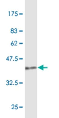 RUNX1, Mouse anti-Human, Clone: 1B4, Abnova 100&mu;g; Unconjugated:Antibodies,