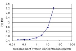 CDA (Human) Matched Antibody Pair, Abnova&trade;