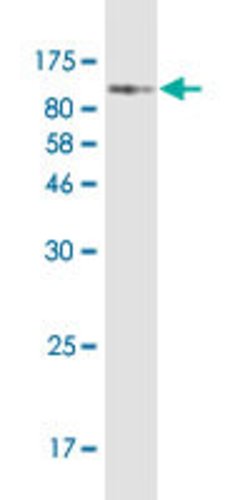 CDH11, Mouse anti-Human, Clone: 2C67, Abnova 100&mu;g; Unconjugated:Antibodies,