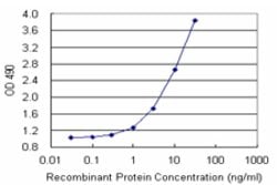 DFFA (Human) Matched Antibody Pair, Abnova 1 Set; Unconjugated:Antibodies