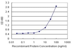 FKBP5 (Human) Matched Antibody Pair, Abnova 1 Set; Unconjugated:Antibodies