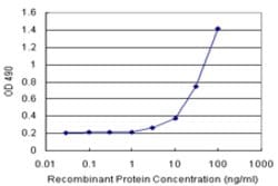 GC (Human) Matched Antibody Pair, Abnova 1 Set; Unconjugated:Antibodies