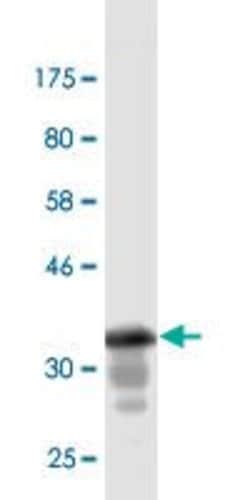 GML, Mouse anti-Human, Clone: 1E7, Abnova 100 &mu;g | Buy Online | Abnova | Fisher Scientific