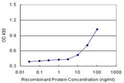 HMBS (Human) Matched Antibody Pair, Abnova&trade;