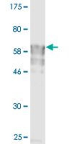 IL11RA, Mouse anti-Human, Clone: 3D4-G4, Abnova 100&mu;g; Unconjugated:Antibodies,