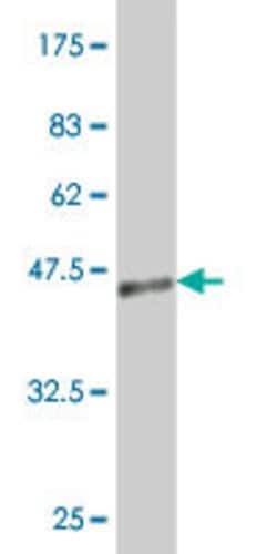 JAG2, Mouse anti-Human, Clone: 2E12, Abnova 100&mu;g; Unconjugated:Antibodies,