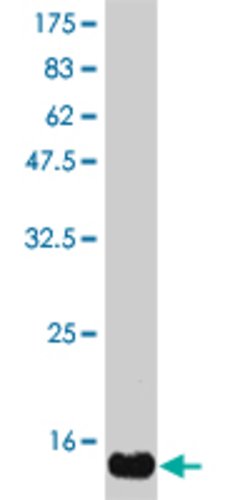 KITLG, Mouse anti-Human, Clone: 2B1, Abnova 100&mu;g; Unconjugated:Antibodies,