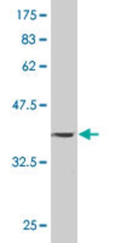PAPPA, Mouse anti-Human, Clone: 1G3, Abnova 100&mu;g; Unconjugated:Antibodies,