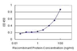 PGM3 (Human) Matched Antibody Pair, Abnova&trade;