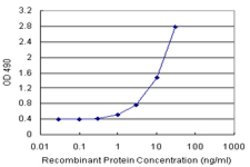 PPP3R2 (Human) Matched Antibody Pair, Abnova 1 Set; Unconjugated:Antibodies