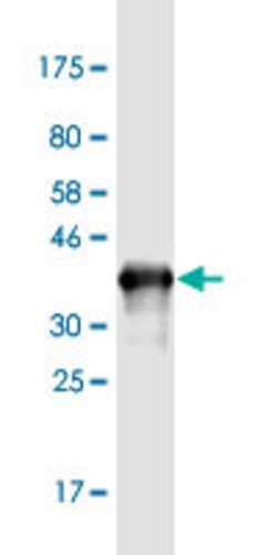 MAP2K7, Mouse anti-Human, Clone: 3G21, Abnova 100&mu;g; Unconjugated:Antibodies,