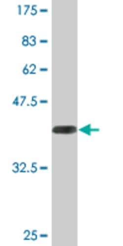 PSMB8, Mouse anti-Human, Clone: 4E4, Abnova 100 &mu;g | Buy Online | Abnova | Fisher Scientific