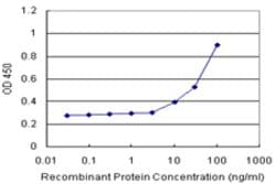 RLN1 (Human) Matched Antibody Pair, Abnova 1 Set; Unconjugated:Antibodies
