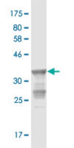 STAR, Mouse anti-Human, Clone: 2B5, Abnova 100 &mu;g | Buy Online | Abnova | Fisher Scientific