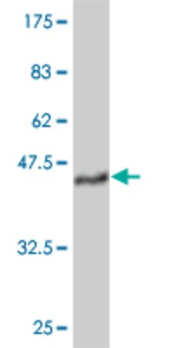 TEK, Mouse anti-Human, Clone: 4G9, Abnova 100&mu;g; Unconjugated:Antibodies,
