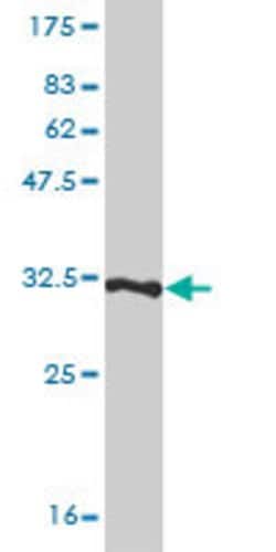 TMSB4X, Mouse anti-Human, Clone: 4H7, Abnova 100&mu;g; Unconjugated:Antibodies,