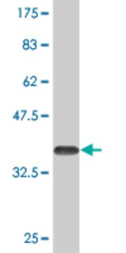 PCGF2, Mouse anti-Human, Clone: 3E4, Abnova 100&mu;g; Unconjugated:Antibodies,