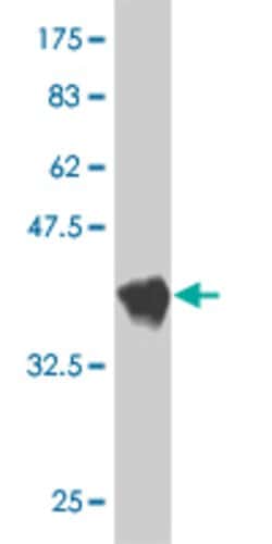 SLC6A5, Mouse anti-Human, Clone: 3B3, Abnova 100&mu;g; Unconjugated:Antibodies,
