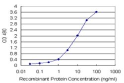 PNMA1 (Human) Matched Antibody Pair, Abnova&trade;