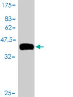 TCL1B, Mouse anti-Human, Clone: 2A12, Abnova 100 &mu;g | Buy Online | Abnova | Fisher Scientific
