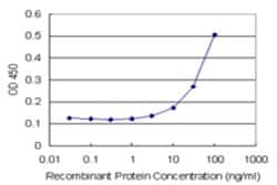 ACTL7B (Human) Matched Antibody Pair, Abnova&trade;